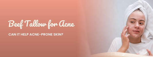 Beef Tallow for Acne: Can It Help Acne-Prone Skin?